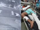 CG Crime News: The miscreants chased and beat the contractor, thrashed him with sticks and rods, his treatment is going on in the hospital